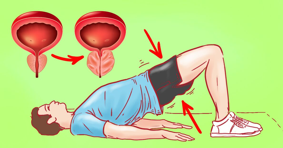 慢性前列腺炎的治疗性锻炼